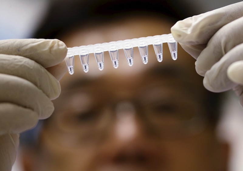 Dr Masafumi Inoue of Agency for Science Technology and Research's Experimental Therapeutics Centre shows a sample to be tested with the Zika virus diagnostic test kit at their laboratory in Singapore, February 10, 2016. u00e2u20acu201d Reuters pic