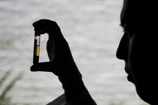 This file photo taken on April 26, 2012 shows a scientist looking at a blood sample in a laboratory at the Centre for Scientific Research Caucaseco in the outskirts of Cali, Colombia. u00e2u20acu201d AFP pic