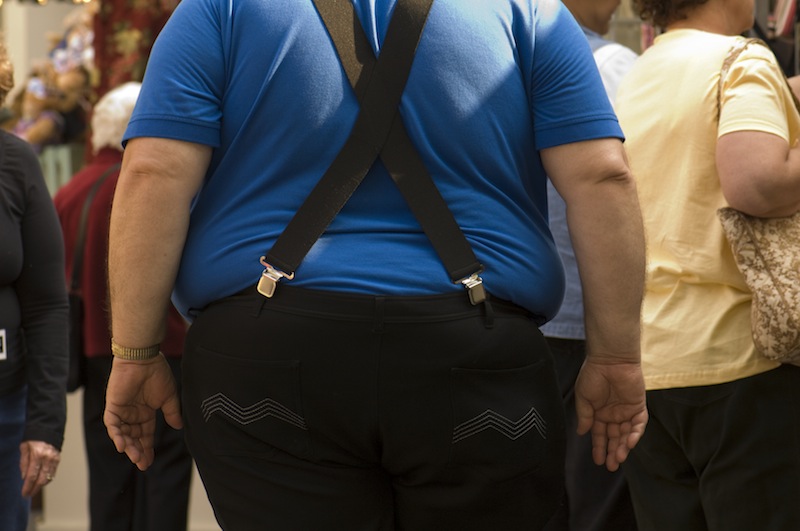 Being obese doubles the risk of developing kidney disease. u00e2u20acu201d AFP pic