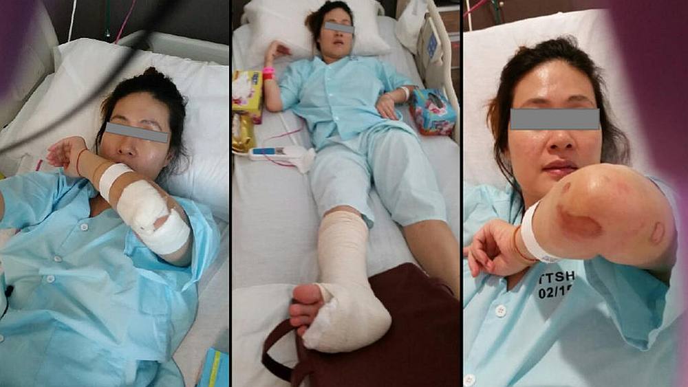 Chan Hui Peng, who fell into a manhole in Singapore, was warded at Tan Tock Seng Hospital for five days before getting further treatment at Mount Elizabeth Hospital. u00e2u20acu201d Picture courtesy of Legalstandard LLP via TODAY