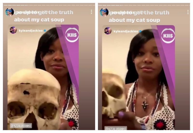 Azealia Banks proudly showing the fractured skull of a six-year-old in an Australia zoom interview. u00e2u20acu201d Instagram screenshot 