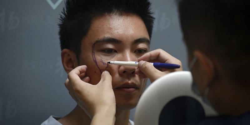 A doctor marking scientific researcher Xia Shurong's face before getting plastic surgery at a clinic in Beijing. u00e2u20acu201d AFP pic