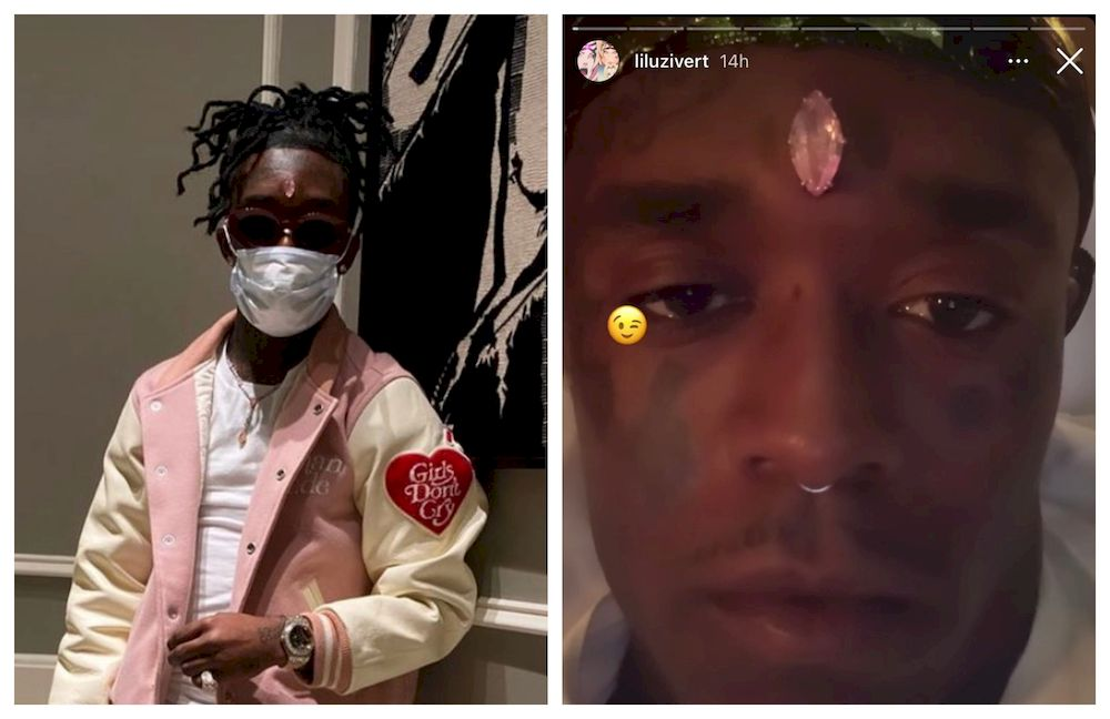American rapper Lil Uzi Vert had his RM99.5 million diamond ripped from his forehead during a performance recently. u00e2u20acu201d Pictures from Instagram/Lil Uzi Vert